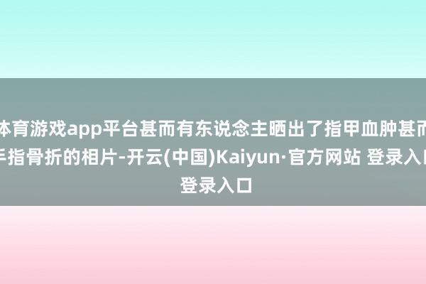 体育游戏app平台甚而有东说念主晒出了指甲血肿甚而手指骨折的相片-开云(中国)Kaiyun·官方网站 登录入口